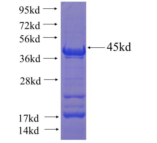 ZBTB22 fusion protein Ag22356 SDS-PAGE