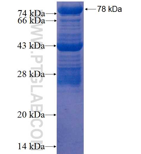 ZBTB22 fusion protein Ag22439 SDS-PAGE