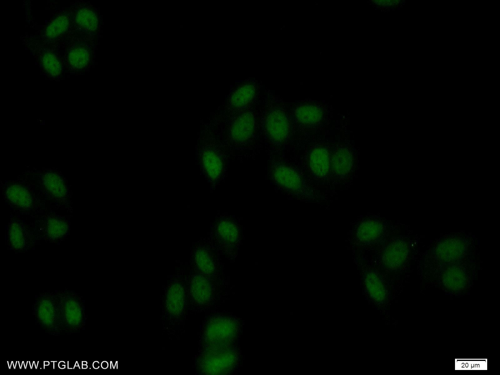 Immunofluorescence (IF) / fluorescent staining of HepG2 cells using ZBTB25 Polyclonal antibody (25631-1-AP)
