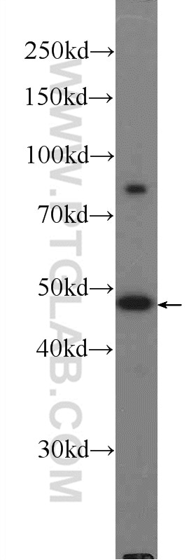 Western Blot (WB) analysis of mouse spleen tissue using ZBTB25 Polyclonal antibody (25631-1-AP)