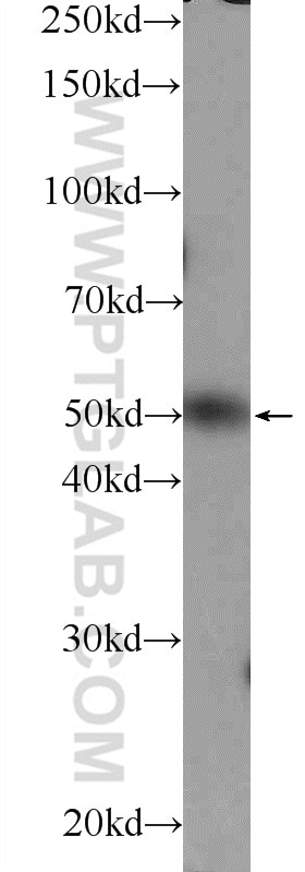 Western Blot (WB) analysis of mouse testis tissue using ZBTB25 Polyclonal antibody (25631-1-AP)