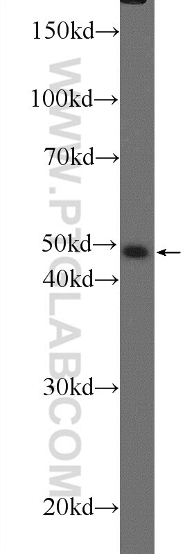 Western Blot (WB) analysis of mouse testis tissue using ZBTB25 Polyclonal antibody (25631-1-AP)