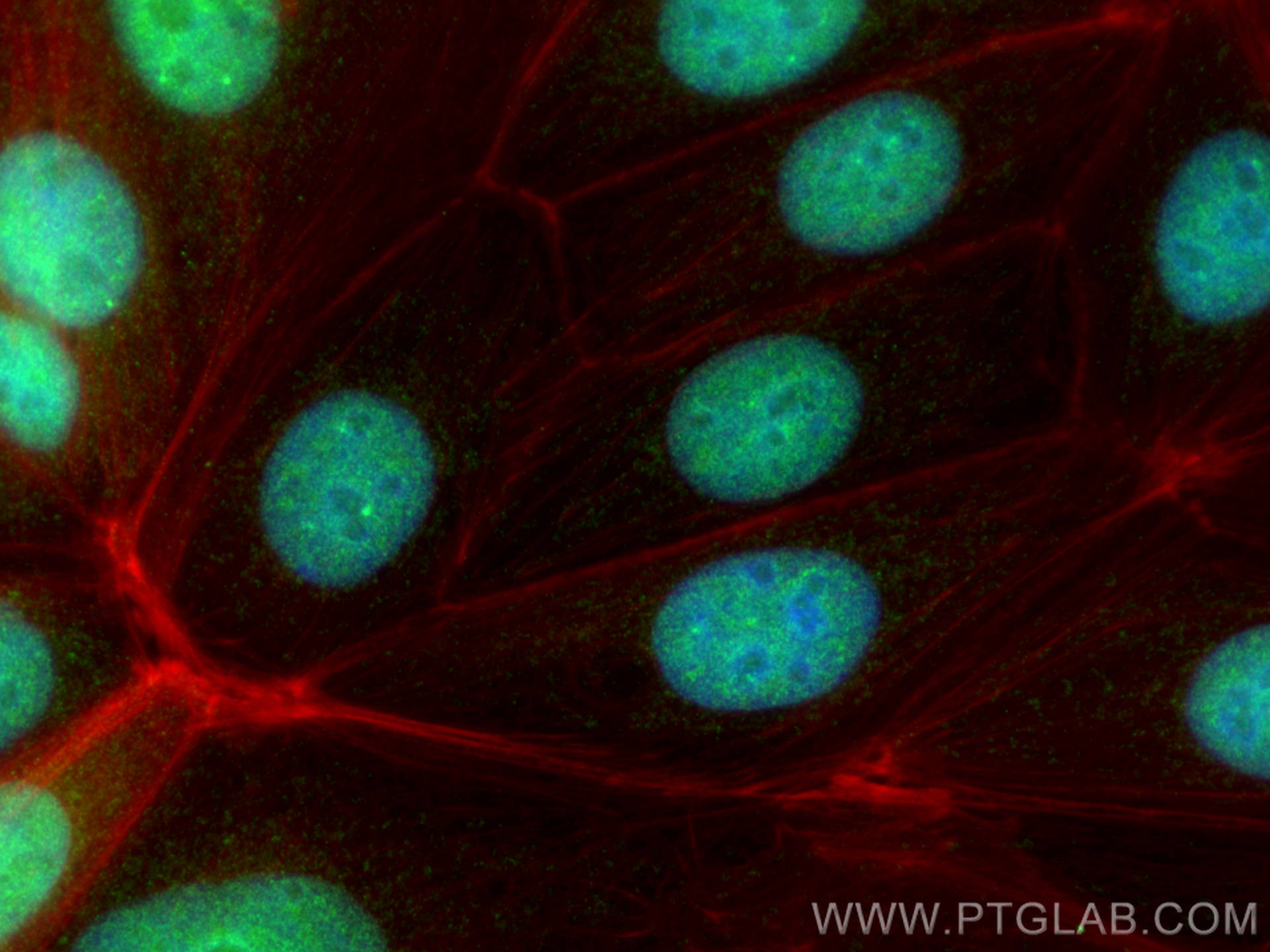 Immunofluorescence (IF) / fluorescent staining of MCF-7 cells using ZBTB32 Polyclonal antibody (12516-1-AP)