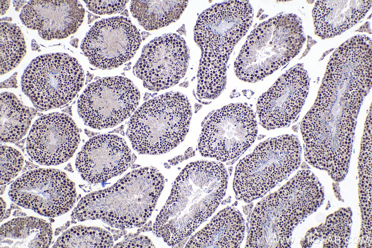 Immunohistochemistry (IHC) staining of mouse testis tissue using ZBTB32 Polyclonal antibody (12516-1-AP)