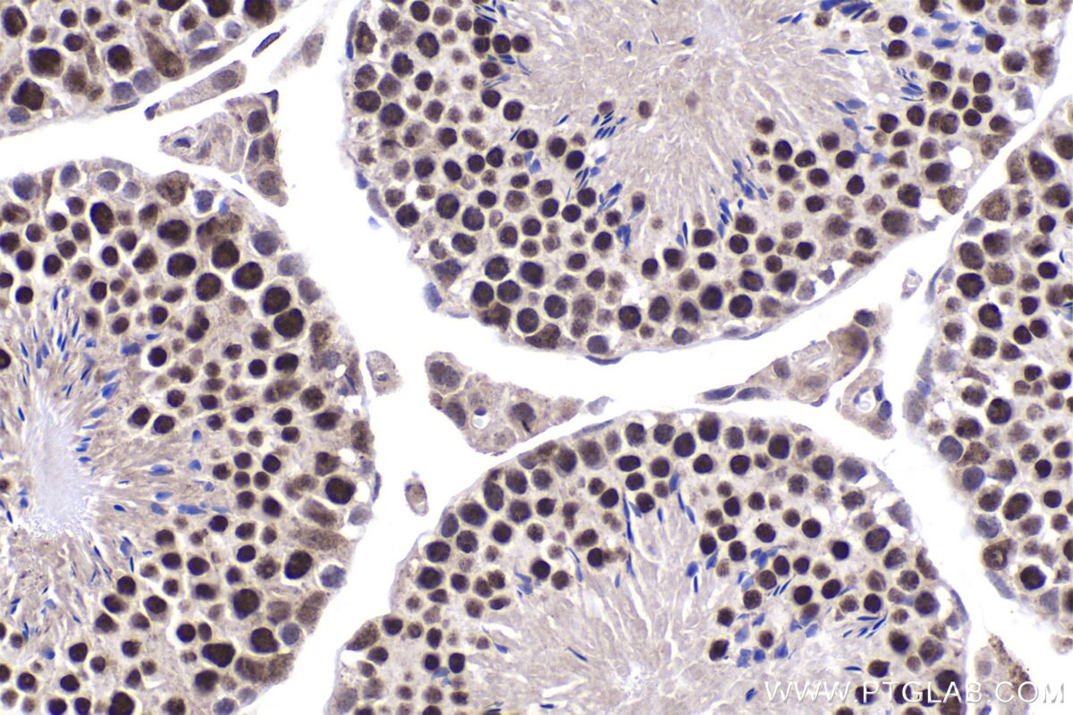 Immunohistochemistry (IHC) staining of mouse testis tissue using ZBTB32 Polyclonal antibody (12516-1-AP)