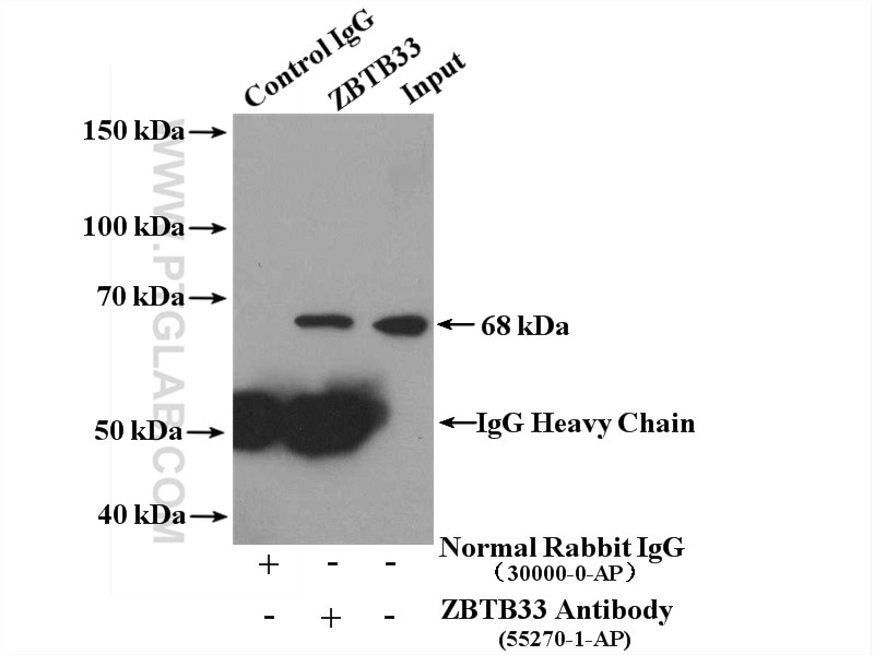 Immunoprecipitation (IP) experiment of A431 cells using ZBTB33 Polyclonal antibody (55270-1-AP)