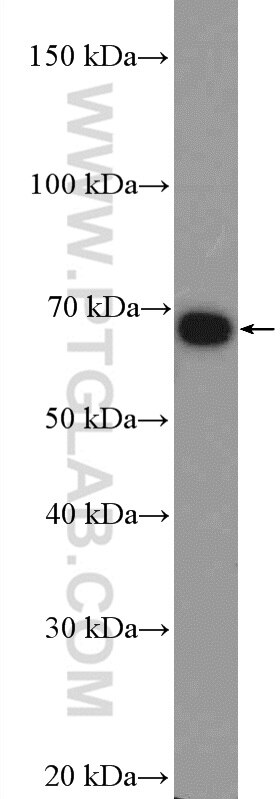 Western Blot (WB) analysis of A431 cells using ZBTB33 Polyclonal antibody (55270-1-AP)