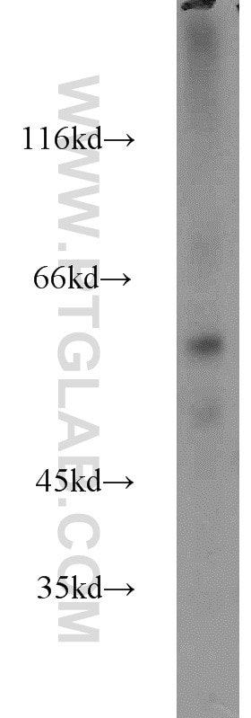 Western Blot (WB) analysis of mouse brain tissue using ZBTB37 Polyclonal antibody (19817-1-AP)