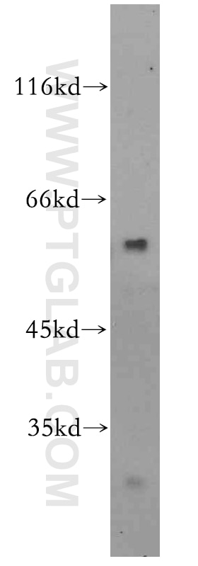 Western Blot (WB) analysis of mouse brain tissue using ZBTB37 Polyclonal antibody (19817-1-AP)