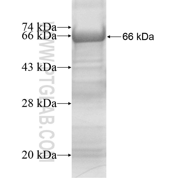 ZBTB37 fusion protein Ag13864 SDS-PAGE