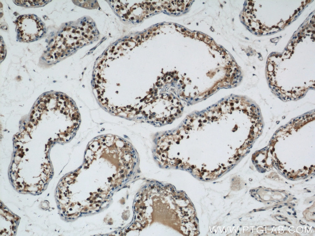 Immunohistochemistry (IHC) staining of human testis tissue using ZBTB38 Polyclonal antibody (21906-1-AP)