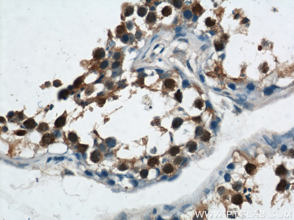 Immunohistochemistry (IHC) staining of human testis tissue using ZBTB38 Polyclonal antibody (21906-1-AP)