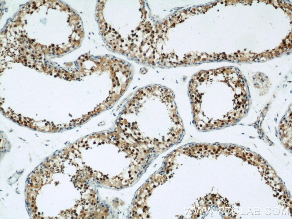 IHC staining of human testis using 21906-1-AP