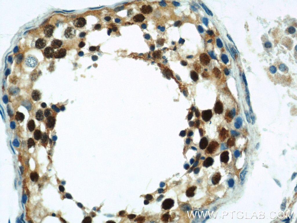 IHC staining of human testis using 21906-1-AP