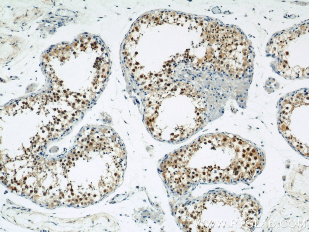 Immunohistochemistry (IHC) staining of human testis tissue using ZBTB38 Polyclonal antibody (21906-1-AP)