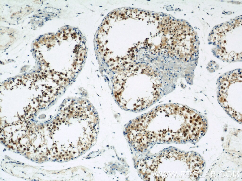 IHC staining of human testis using 21906-1-AP