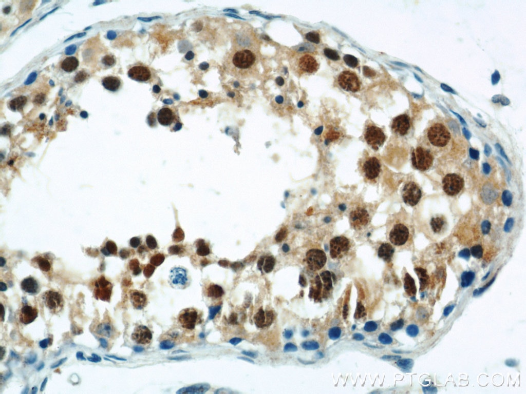 Immunohistochemistry (IHC) staining of human testis tissue using ZBTB38 Polyclonal antibody (21906-1-AP)