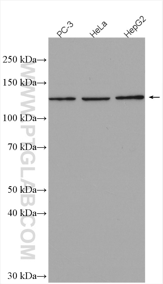 Western Blot (WB) analysis of various lysates using ZBTB38 Polyclonal antibody (21906-1-AP)