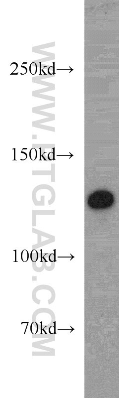 Western Blot (WB) analysis of DU 145 cells using ZBTB38 Polyclonal antibody (21906-1-AP)