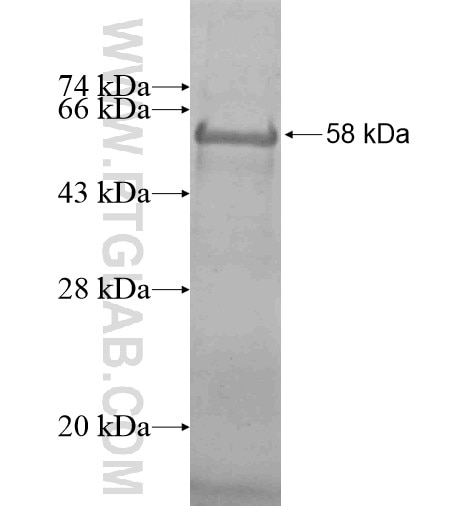 ZBTB38 fusion protein Ag14963 SDS-PAGE