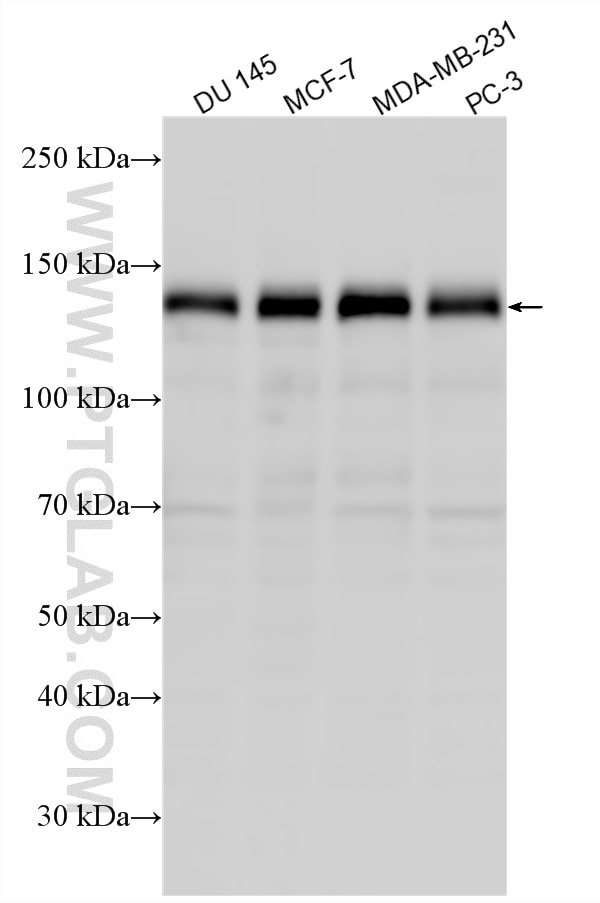 Western Blot (WB) analysis of various lysates using ZBTB4 Polyclonal antibody (17611-1-AP)
