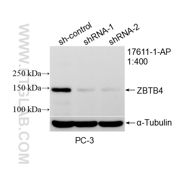 WB analysis of PC-3 using 17611-1-AP (same clone as 17611-1-PBS) Western Blot (WB) analysis of PC-3 cells using ZBTB4 Polyclonal antibody (17611-1-AP)