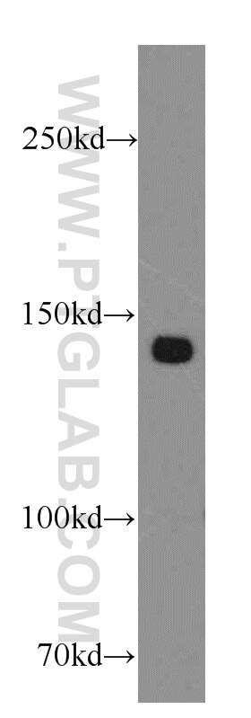 Western Blot (WB) analysis of A431 cells using ZBTB40 Polyclonal antibody (20026-1-AP)