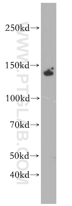 Western Blot (WB) analysis of HepG2 cells using ZBTB40 Polyclonal antibody (20026-1-AP)