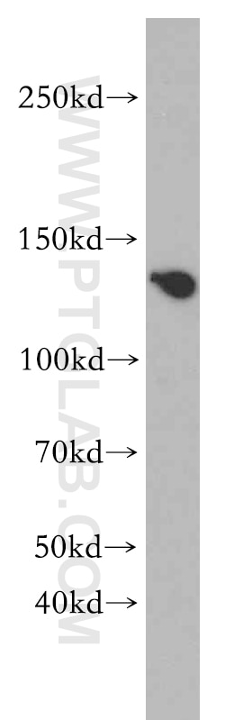 Western Blot (WB) analysis of L02 cells using ZBTB40 Polyclonal antibody (20026-1-AP)