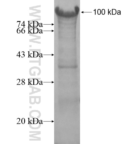 ZBTB43 fusion protein Ag14618 SDS-PAGE
