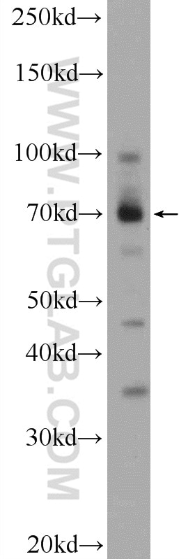 Western Blot (WB) analysis of HL-60 cells using ZBTB44 Polyclonal antibody (25421-1-AP)