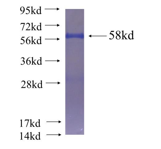 ZBTB44 fusion protein Ag22299 SDS-PAGE