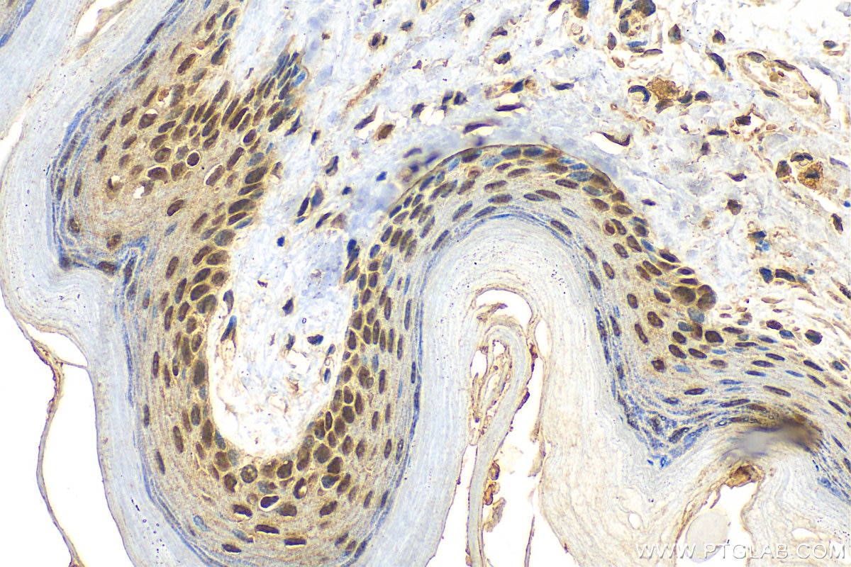 Immunohistochemistry (IHC) staining of mouse skin tissue using ZBTB46 Polyclonal antibody (25455-1-AP)