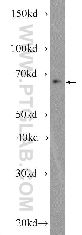 Western Blot (WB) analysis of RAW 264.7 cells using ZBTB46 Polyclonal antibody (25455-1-AP)