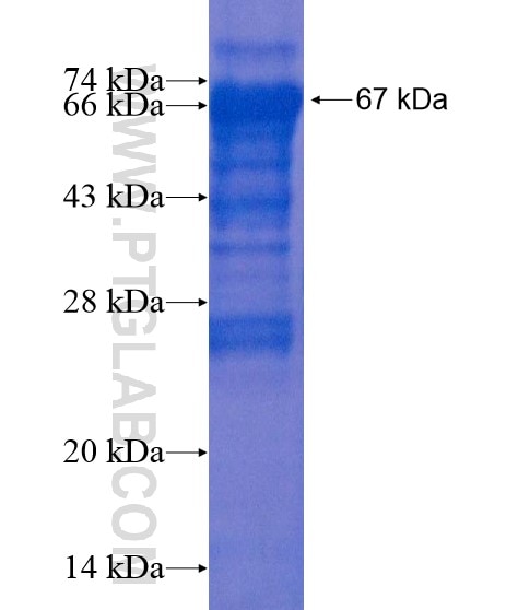 ZBTB46 fusion protein Ag22273 SDS-PAGE