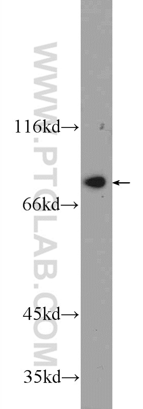 Western Blot (WB) analysis of K-562 cells using ZBTB48 Polyclonal antibody (24665-1-AP)