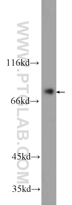 Western Blot (WB) analysis of HEK-293 cells using ZBTB48 Polyclonal antibody (24665-1-AP)