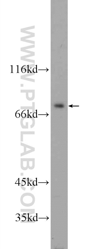 Western Blot (WB) analysis of HepG2 cells using ZBTB48 Polyclonal antibody (24665-1-AP)