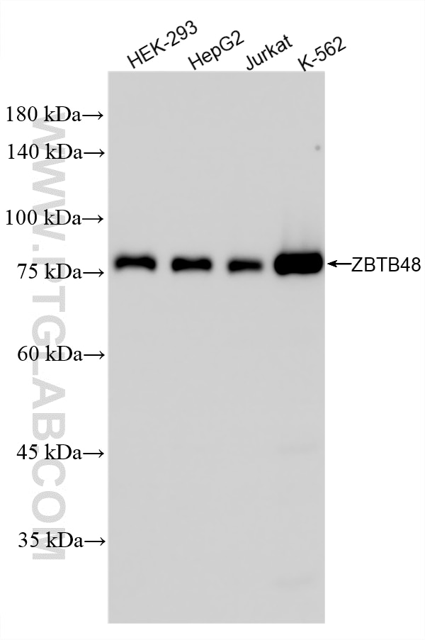 WB analysis using 86981-1-RR (same clone as 86981-1-PBS) Western Blot (WB) analysis of various lysates using ZBTB48 Recombinant monoclonal antibody (86981-1-RR)