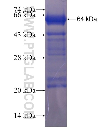 ZBTB48 fusion protein Ag20301 SDS-PAGE