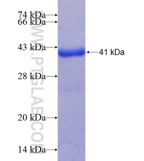ZBTB48 fusion protein Ag20499 SDS-PAGE