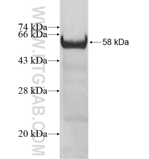 ZBTB6 fusion protein Ag11203 SDS-PAGE