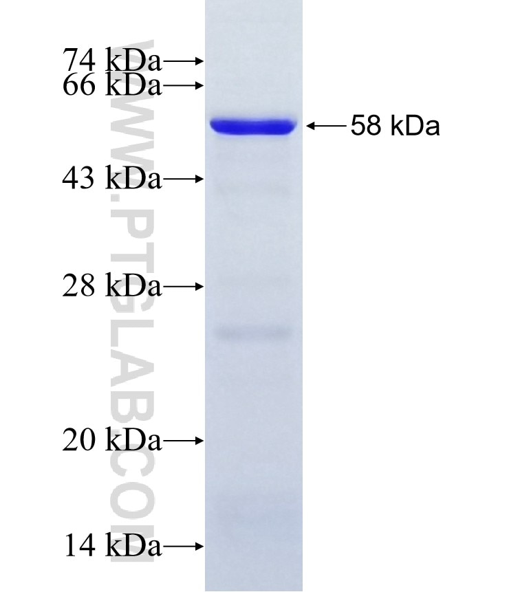 ZBTB6 fusion protein Ag11203 SDS-PAGE