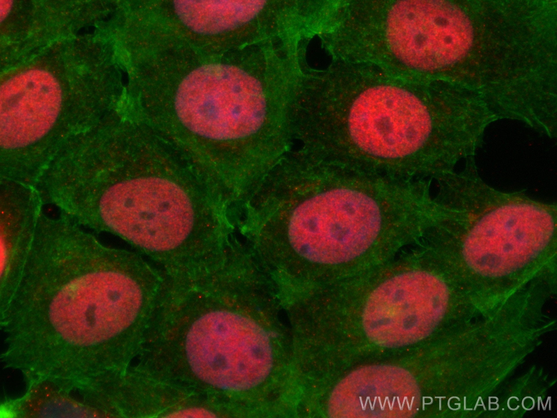 Immunofluorescence (IF) / fluorescent staining of MCF-7 cells using ZBTB7A Polyclonal antibody (18700-1-AP)