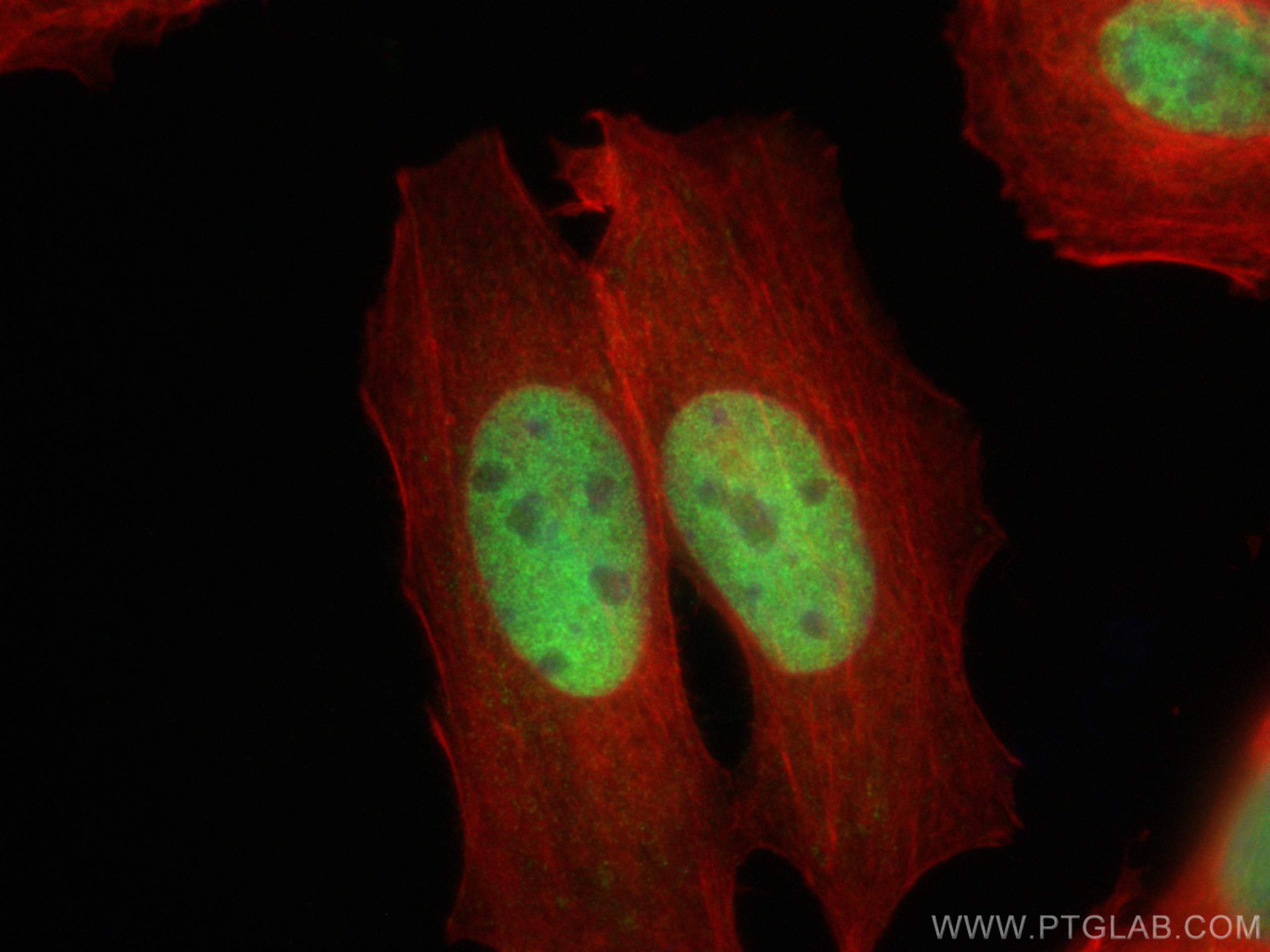 Immunofluorescence (IF) / fluorescent staining of MCF-7 cells using ZBTB7A Polyclonal antibody (30658-1-AP)