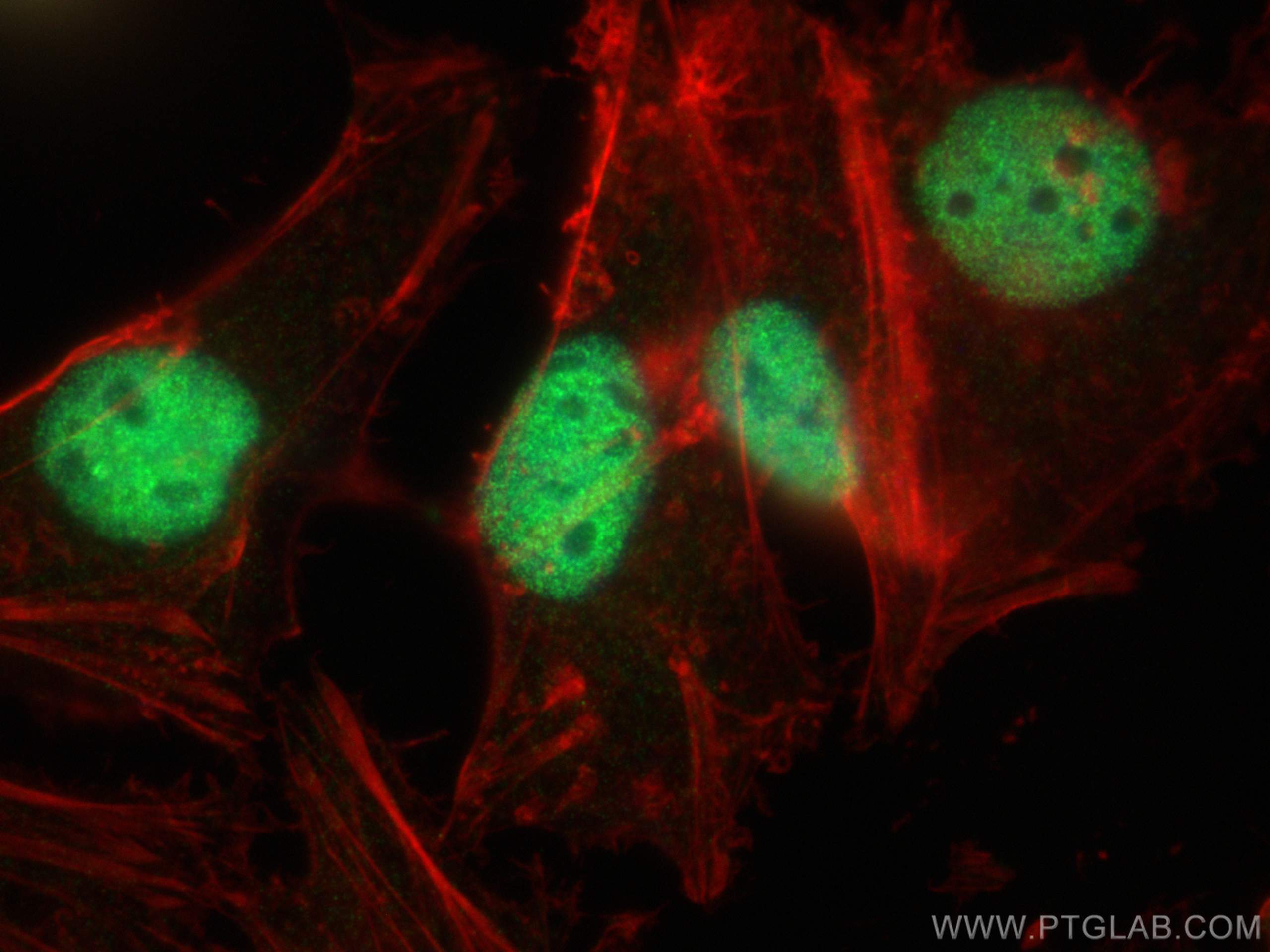 Immunofluorescence (IF) / fluorescent staining of HeLa cells using ZBTB7A Polyclonal antibody (30658-1-AP)