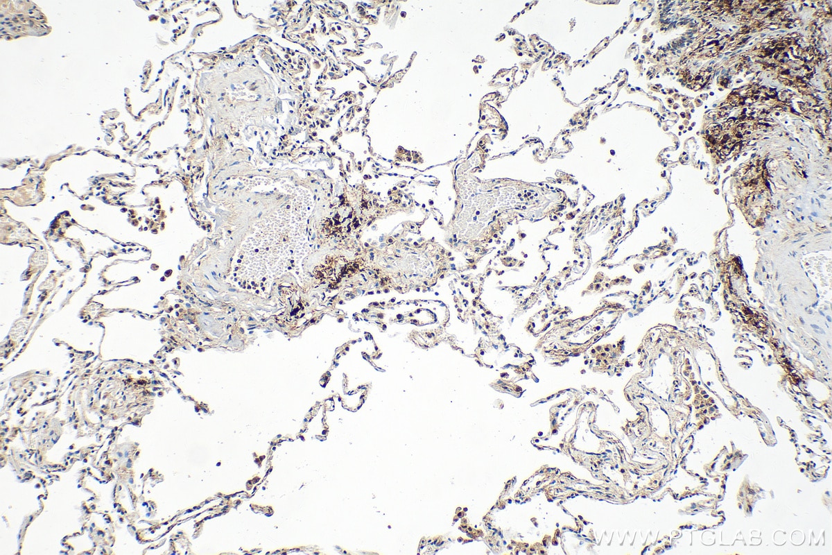 Immunohistochemistry (IHC) staining of human lung tissue using ZBTB7A Polyclonal antibody (30658-1-AP)