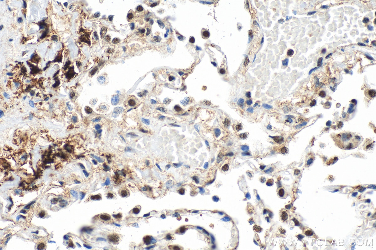 Immunohistochemistry (IHC) staining of human lung tissue using ZBTB7A Polyclonal antibody (30658-1-AP)