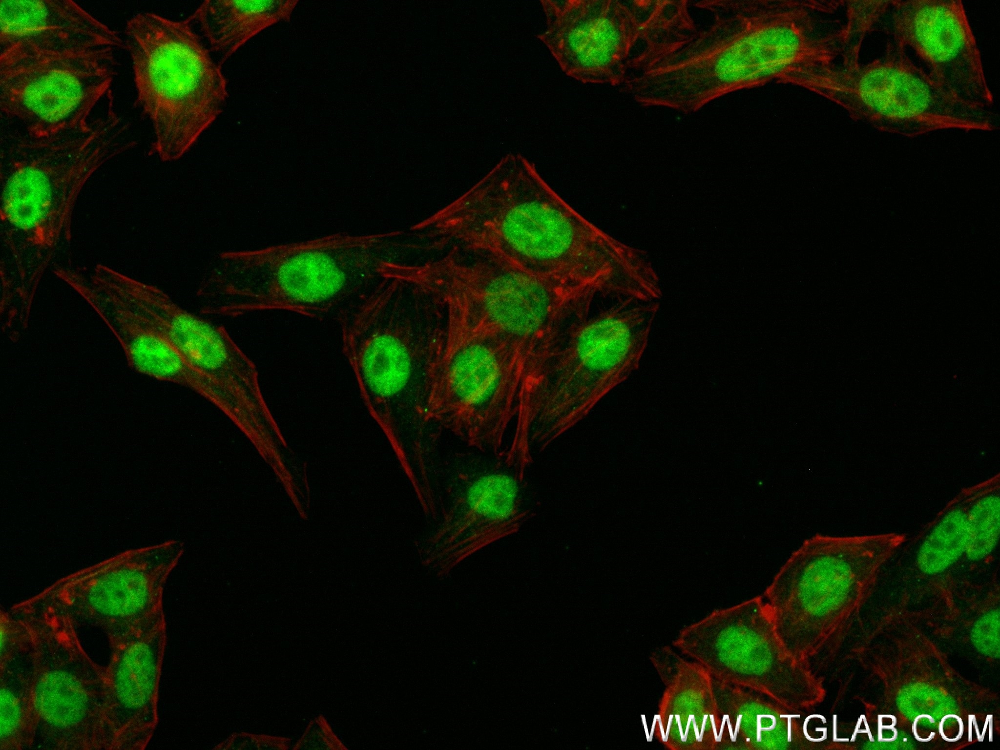 Immunofluorescence (IF) / fluorescent staining of HepG2 cells using ZBTB7A Recombinant antibody (83616-5-RR)