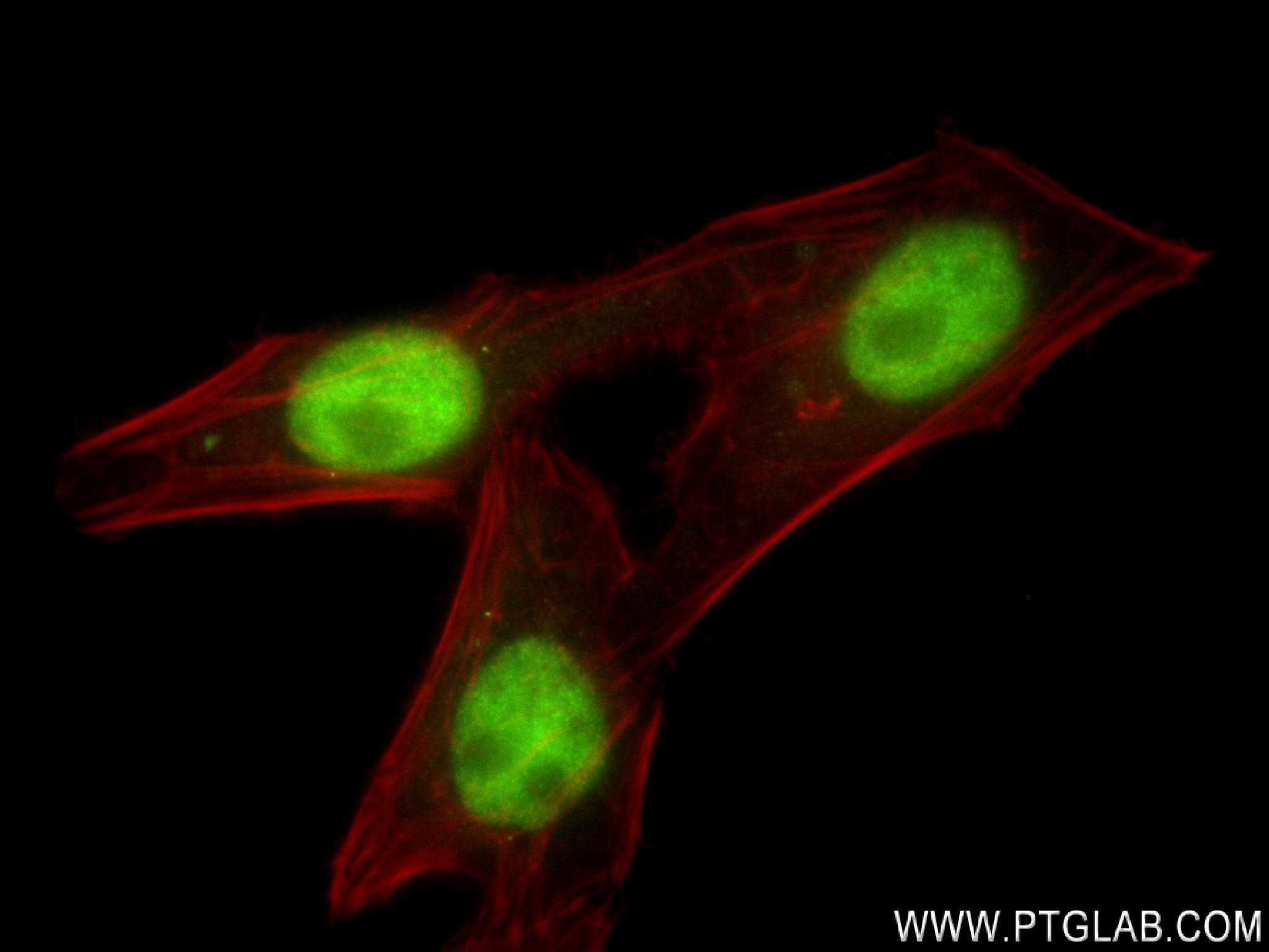 Immunofluorescence (IF) / fluorescent staining of HepG2 cells using ZBTB7A Recombinant antibody (83616-5-RR)